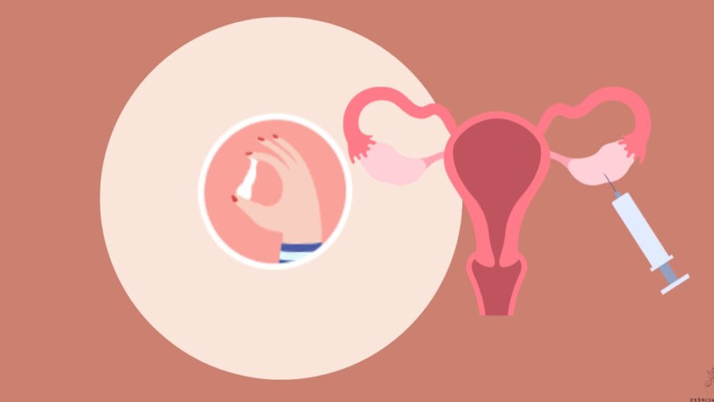 Quels sont les impacts de la fiscalit&eacute; sur la location de meubl&eacute; de tourisme ?